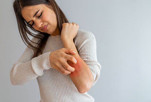 Itchy Skin (Pruritus): Causes And Remedies