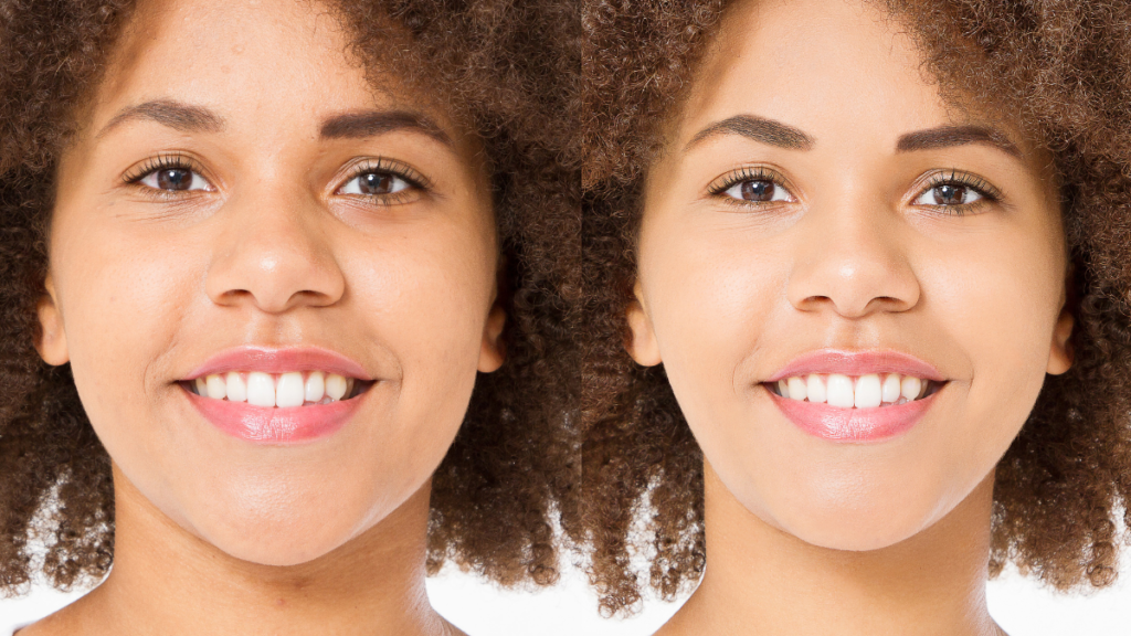 How To Lose Face Fat Quickly: Our Top 10 Tips